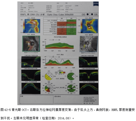 ZY016_234_4.gif